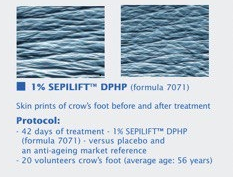 Результати користуватися кремом з біопептидом Sepilift